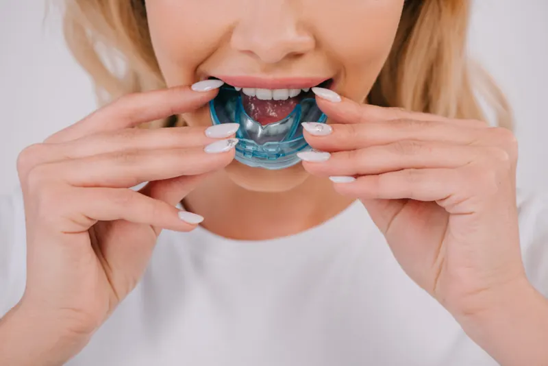 Patient seating a clear aligner tray
