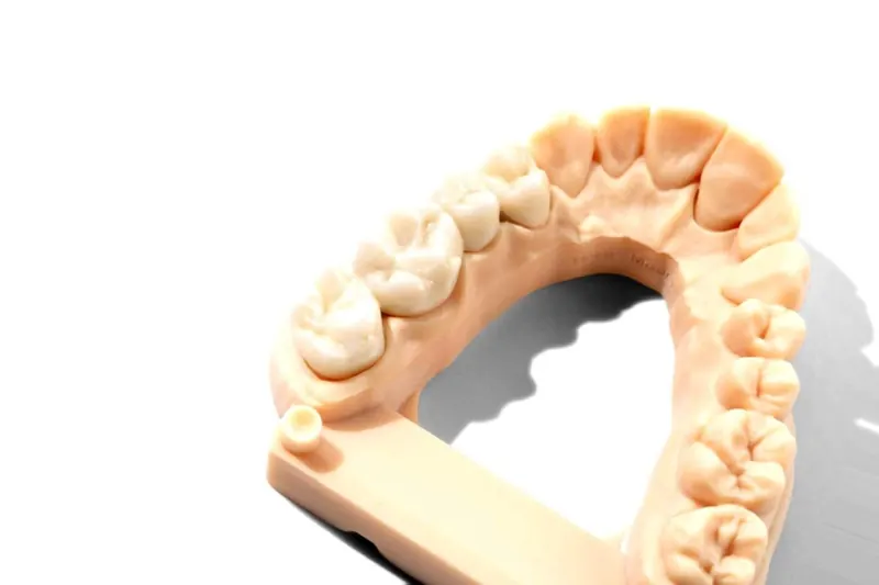 Full-arch dental model of the upper teeth