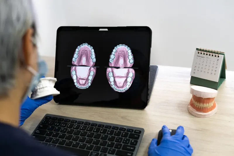 Technician reviewing a digital full-arch design on a monitor next to a stone model